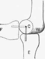 Diagram of the action of the knee joint.