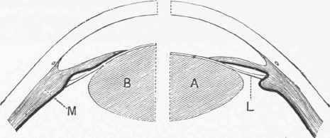 Diagram showing the changes in the lens during accommodation.