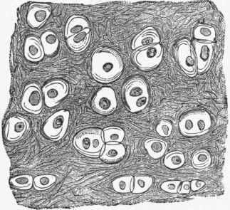Elastic fibro cartilage, showing cells in capsules and elastic fibres in matrix.
