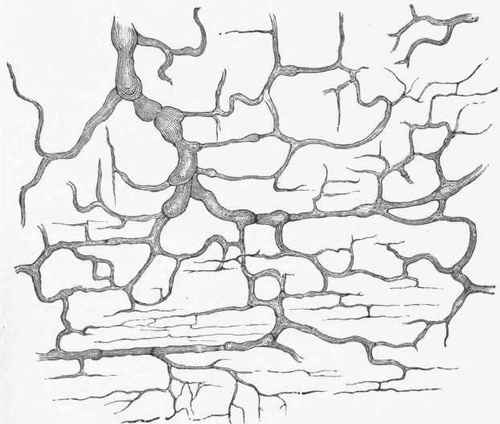 Lymphatic Network from between the Muscle Coats of the Intestinal Wall, with fine vessels and many valves, causing the walls to bulge.