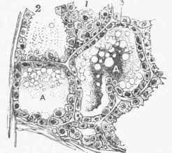 Section of the Mammary Gland of a Cat in the early stages of lactation.