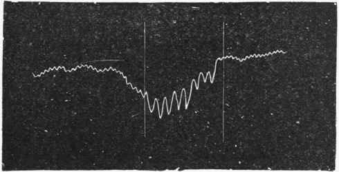 Tracing, showing the effect of weak Stimulation of Vagus Nerve.
