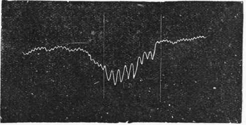Tracing, showing the effect of weak Stimulation of Vagus Nerve.