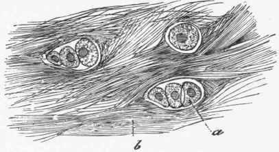 White fibro cartilage, showing cells (a) in capsules and fibrillar matrix (b).