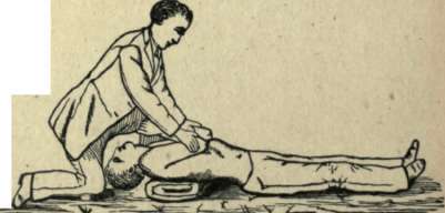 ARTIFICIAL RESPIRATION 2