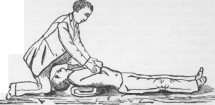 Artificial Respiration 2