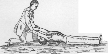 Artificial Respiration