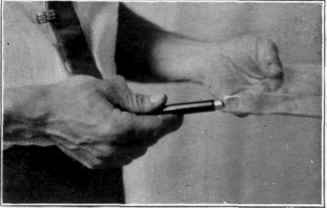 Fig. 85. Tapping under the scratch in the glass to start a crack. (Step 2.)