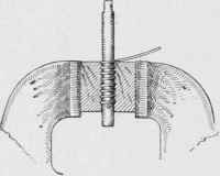 A simple method for making a coiled spring