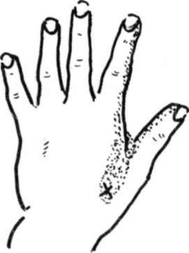 signal from bladder