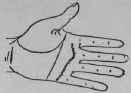 3 Malformation 648