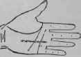 3 Malformation 871