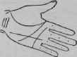 B In Connection With Other Indications I Length 876