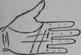 Deafness Wound In The Legs 79