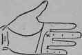 Deafness Wound In The Legs 82