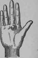 I Physical Peculiarities 227