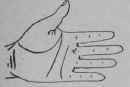 Parlysis 93