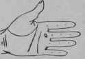 Parlysis 97