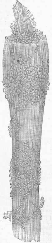 Achorion Schoenleinii.