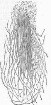 Leptothrix buccalis.