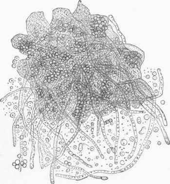 Oidium albicans.