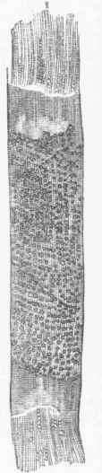 Tricophyton tonsurans.