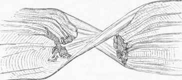 Striped Muscular Fibre, highly magnified, torn across, and showing the Sarcolemma.