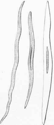 Unstriped Muscular Fibres, highly magnified, from the walls of the Kenal Vein.