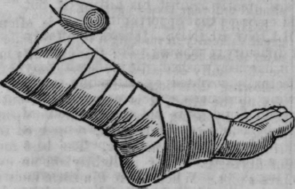 Bandages 583