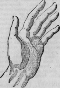 Chiromancy 205